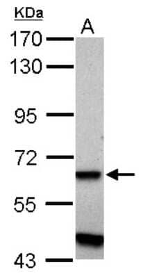 Western Blot ZNF554 Antibody