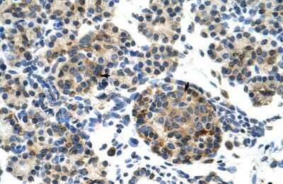 Immunohistochemistry-Paraffin: ZNF555 Antibody [NBP1-80167] - Human Pancrease (Epithelial cells of acinus indicated with arrows), 4-8ug/ml.