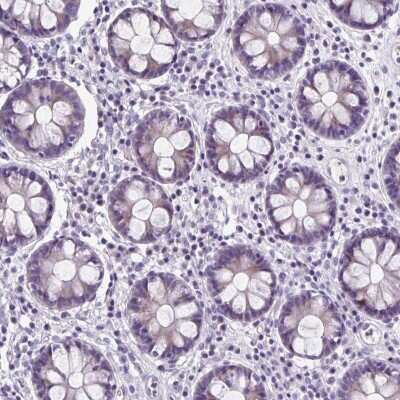 Immunohistochemistry-Paraffin ZNF555 Antibody