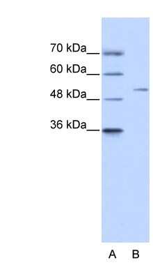 Western Blot: ZNF555 Antibody [NBP1-80166] - 293T cells lysate, concentration 0.2-1 ug/ml.