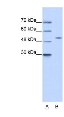Western Blot: ZNF555 Antibody [NBP1-80167] - 293T cell lysate, Antibody Titration: 0.2-1 ug/ml