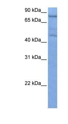 Western Blot: ZNF555 Antibody [NBP1-80419] - Hela cell lysate, concentration 0.2-1 ug/ml.