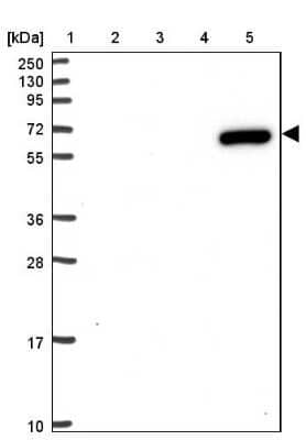 Western Blot ZNF555 Antibody