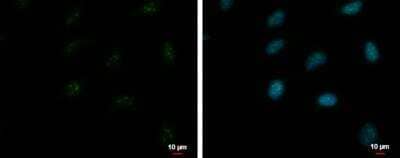 Immunocytochemistry/Immunofluorescence: ZNF556 Antibody [NBP2-43598] - Analysis of Sample: HeLa cells were fixed in 4% paraformaldehyde/PBS for 15 min. Green: ZNF556 protein stained by ZNF556 antibody diluted at 1:500. Blue: Hoechst 33342 staining.