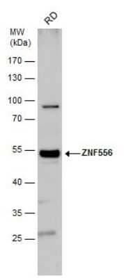 Western Blot: ZNF556 Antibody [NBP2-43598] - Analysis of whole cell extracts (30 ug) was separated by 10% SDS-PAGE, and the membrane was blotted with ZNF556 antibody diluted by 1:1000.
