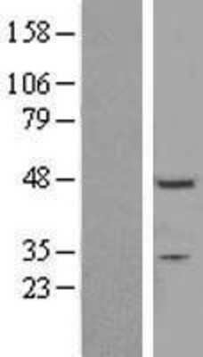 Western Blot: ZNF558 Overexpression Lysate (Adult Normal) [NBL1-18184] Left-Empty vector transfected control cell lysate (HEK293 cell lysate); Right -Over-expression Lysate for ZNF558.