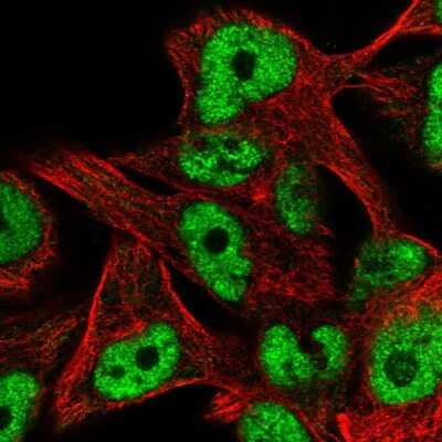 Immunocytochemistry/Immunofluorescence: ZNF559 Antibody [NBP2-57034] - Staining of human cell line SK-MEL-30 shows localization to nucleoplasm.