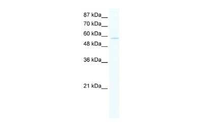 Western Blot: ZNF559 Antibody [NBP2-86516] - WB Suggested Anti-ZNF559 Antibody Titration: 5.0ug/ml. ELISA Titer: 1:1562500. Positive Control: Jurkat cell lysate