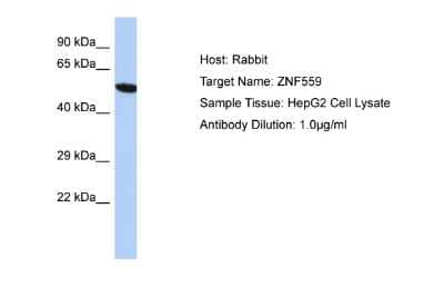 Western Blot: ZNF559 Antibody [NBP2-86517] - Host: Rabbit. Target Name: ZNF559. Sample Type: HepG2 Whole Cell lysates. Antibody Dilution: 1.0ug/ml