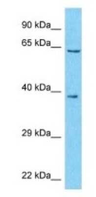Western Blot: ZNF559-ZNF177 Antibody [NBP3-09196] - Western blot analysis of ZNF559-ZNF177 in Stomach Tumor lysates. Antibody dilution at 1.0ug/ml