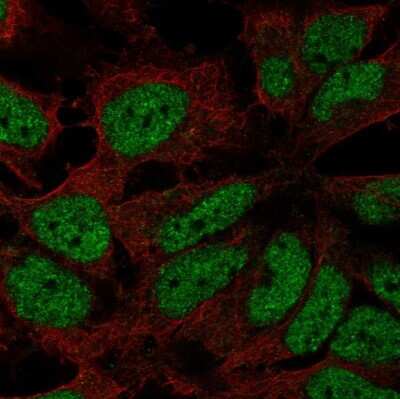 Immunocytochemistry/Immunofluorescence: ZNF560 Antibody [NBP2-68662] - Staining of human cell line AF22 shows localization to nucleoplasm.