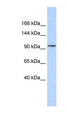 Western Blot: ZNF560 Antibody [NBP1-80161] - Hela cell lysate, concentration 0.2-1 ug/ml.