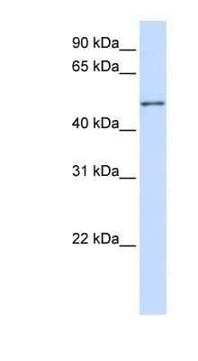 Western Blot: ZNF561 Antibody [NBP1-80148] - 293T cells lysate, concentration 0.2-1 ug/ml.