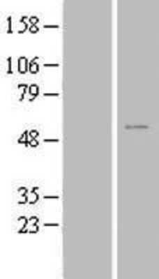 Western Blot: ZNF561 Overexpression Lysate (Adult Normal) [NBL1-18186] Left-Empty vector transfected control cell lysate (HEK293 cell lysate); Right -Over-expression Lysate for ZNF561.