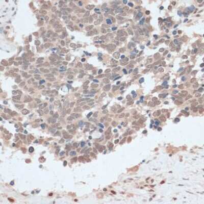 Immunohistochemistry-Paraffin ZNF562 Antibody - Azide and BSA Free