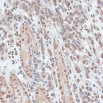 Immunohistochemistry-Paraffin ZNF562 Antibody - Azide and BSA Free