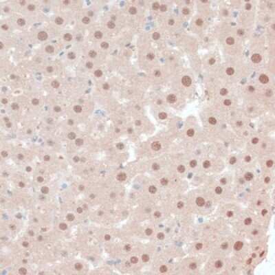 Immunohistochemistry-Paraffin ZNF562 Antibody - Azide and BSA Free