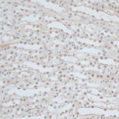Immunohistochemistry-Paraffin ZNF562 Antibody - Azide and BSA Free
