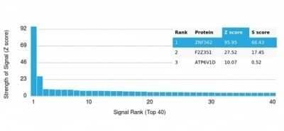 Protein Array: ZNF562 Antibody (PCRP-ZNF562-1A1) - Azide and BSA Free [NBP3-14150] - Analysis of Protein Array containing more than 19,000 full-length human proteins using ZNF562 Antibody (PCRP-ZNF562-1A1).