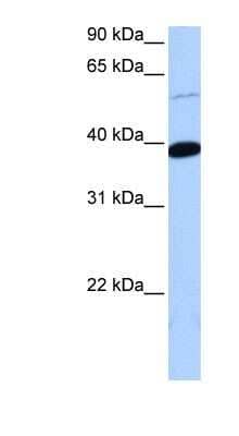 Western Blot: ZNF562 Antibody [NBP1-79456] - 721_B cell lysate, concentration 0.2-1 ug/ml.