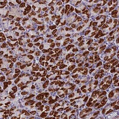 Immunohistochemistry-Paraffin: ZNF563 Antibody [NBP1-81973] - Staining of human stomach, lower shows strong cytoplasmic positivity in glandular cells.