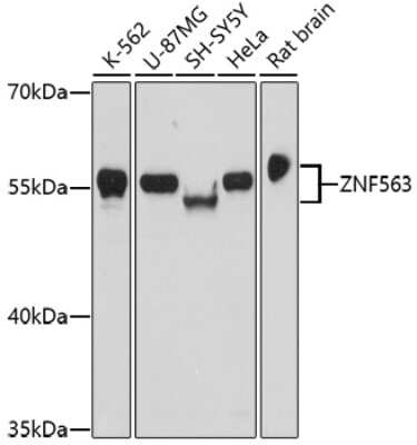 Western Blot: ZNF563 Antibody [NBP2-93199] - Analysis of extracts of various cell lines, using ZNF563 at 1:1000 dilution. Secondary antibody: HRP Goat Anti-Rabbit IgG (H+L) at 1:10000 dilution. Lysates/proteins: 25ug per lane. Blocking buffer: 3% nonfat dry milk in TBST. Detection: ECL Basic Kit . Exposure time: 30s.