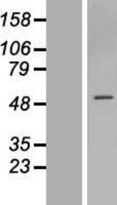 Western Blot: ZNF563 Overexpression Lysate (Adult Normal) [NBL1-18187] Left-Empty vector transfected control cell lysate (HEK293 cell lysate); Right -Over-expression Lysate for ZNF563.