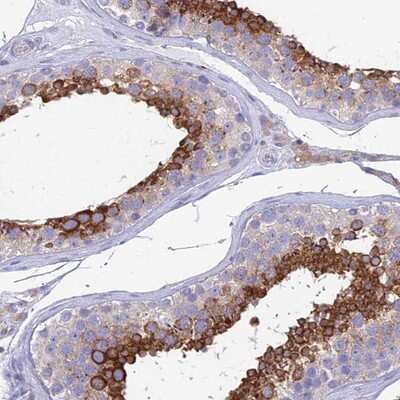 Immunohistochemistry-Paraffin: ZNF564 Antibody [NBP1-92630] - Staining of human testis shows strong cytoplasmic positivity in cells of seminiferous ducts..