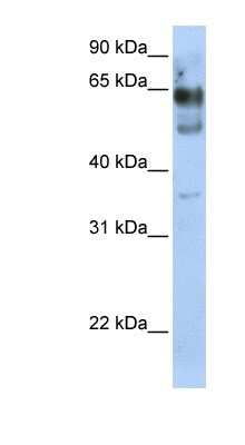 Western Blot: ZNF564 Antibody [NBP1-80144] - Transfected 293T cell lysate, concentration 0.2-1 ug/ml.