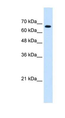 Western Blot: ZNF564 Antibody [NBP1-80396] - Jurkat cell lysate, concentration 0.2-1 ug/ml.