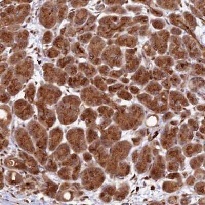 Immunohistochemistry-Paraffin: ZNF565 Antibody [NBP1-81951] - Staining of human pancreas shows strong cytoplasmic positivity in exocrine glandular cells.