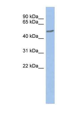 Western Blot: ZNF565 Antibody [NBP1-79419] - Human kidney lysate, concentration 0.2-1 ug/ml.