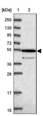 Western Blot: ZNF565 Antibody [NBP1-81951] - Lane 1: Marker  [kDa] 250, 130, 95, 72, 55, 36, 28, 17, 10.  Lane 2: Human cell line RT-4