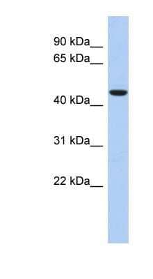 Western Blot: ZNF566 Antibody [NBP1-80126] - Human kidney lysate, concentration 0.2-1 ug/ml.