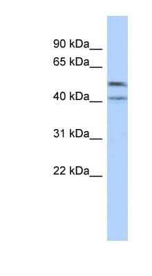 Western Blot: ZNF566 Antibody [NBP1-80382] - COLO205 cells lysate, concentration 0.2-1 ug/ml.