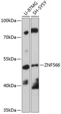Western Blot: ZNF566 Antibody [NBP2-94217] - Analysis of extracts of various cell lines, using ZNF566 at 1:1000 dilution. Secondary antibody: HRP Goat Anti-Rabbit IgG (H+L) at 1:10000 dilution. Lysates/proteins: 25ug per lane. Blocking buffer: 3% nonfat dry milk in TBST. Detection: ECL Basic Kit . Exposure time: 30s.