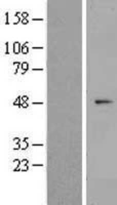 Western Blot: ZNF566 Overexpression Lysate (Adult Normal) [NBP2-09741] Left-Empty vector transfected control cell lysate (HEK293 cell lysate); Right -Over-expression Lysate for ZNF566.
