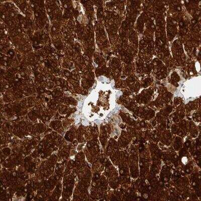 Immunohistochemistry-Paraffin: ZNF567 Antibody [NBP1-81070] - Staining of human liver shows strong cytoplasmic positivity in hepatocytes.