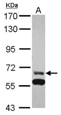 Western Blot: ZNF567 Antibody [NBP2-21027] - Sample (30 ug of whole cell lysate) A: HepG2 7. 5% SDS PAGE gel, diluted at 1:1000.