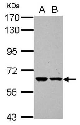 Western Blot: ZNF567 Antibody [NBP2-21028] - Sample (30 ug of whole cell lysate) A: PC-3 B: U87-MG 7. 5% SDS PAGE gel, diluted at 1:1000.