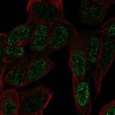 Immunocytochemistry/ Immunofluorescence ZNF568 Antibody - BSA Free