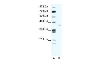 Western Blot ZNF568 Antibody - BSA Free