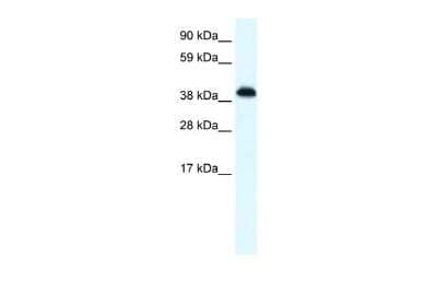 Western Blot: ZNF568 Antibody [NBP2-83871] - WB Suggested Anti-ZNF568 Antibody Titration: 0.2-1 ug/ml. ELISA Titer: 1:62500. Positive Control: Human brain