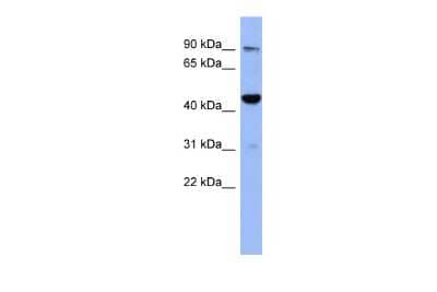 Western Blot: ZNF569 Antibody [NBP2-83874] - WB Suggested Anti-ZNF569 Antibody Titration: 0.2-1 ug/ml. ELISA Titer: 1:62500. Positive Control: Human Thymus