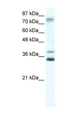 Western Blot: ZNF570 Antibody [NBP1-80143] - Jurkat cell lysate, concentration 0.2-1 ug/ml.
