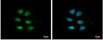 Immunocytochemistry/Immunofluorescence: ZNF571 Antibody [NBP2-15176] - NT2D1 cells were fixed in 4% paraformaldehyde at RT for 15 min. Green: ZNF571 protein stained by ZNF571 antibody [N1N2], N-term diluted at 1:500. Blue: Hoechst 33342 staining.