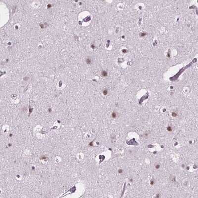 Immunohistochemistry: ZNF572 Antibody [NBP2-39077] - Staining of human cerebral cortex shows moderate nuclear positivity in neuronal cells.