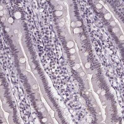 Immunohistochemistry-Paraffin: ZNF572 Antibody [NBP2-39077] - Staining of human duodenum shows low expression as expected.