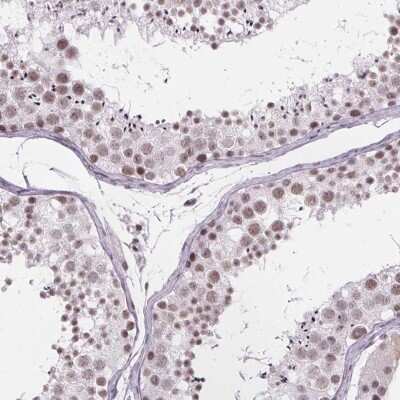 Immunohistochemistry-Paraffin: ZNF572 Antibody [NBP2-39077] - Staining of human testis shows high expression.