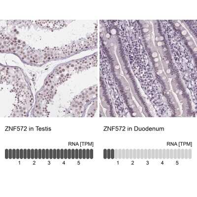Immunohistochemistry-Paraffin: ZNF572 Antibody [NBP2-39077] - Staining in human testis and duodenum tissues using anti-ZNF572 antibody. Corresponding ZNF572 RNA-seq data are presented for the same tissues.